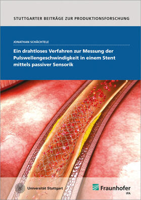 Ein drahtloses Verfahren zur Messung der Pulswellengeschwindigkeit in einem Stent mittels passiver Sensorik