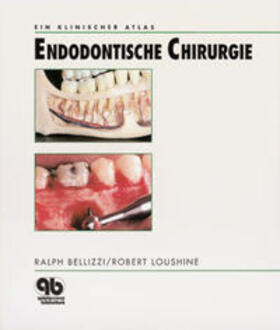 Endodontische Chirurgie