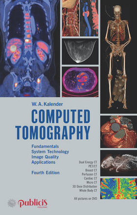 Computed Tomography