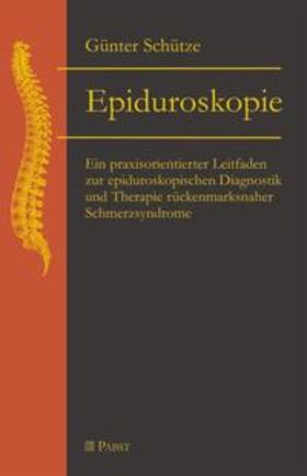 Epiduroskopie
