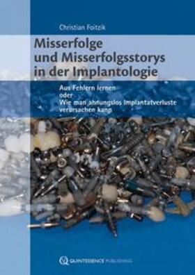 Misserfolge und Misserfolgsstorys in der Implantologie