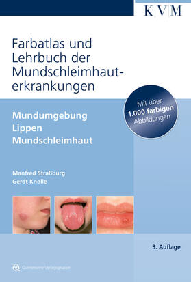 Farbatlas und Lehrbuch der Mundschleimhauterkrankungen