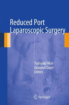 Reduced Port Laparoscopic Surgery
