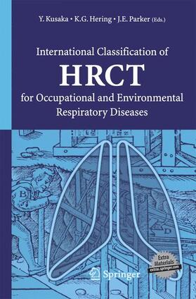 International Classification of HRCT for Occupational and Environmental Respiratory Diseases