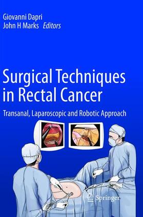 Surgical Techniques in Rectal Cancer