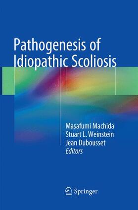 Pathogenesis of Idiopathic Scoliosis