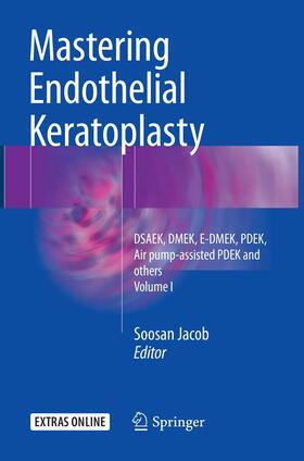 Mastering Endothelial Keratoplasty