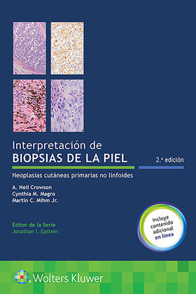 Interpretacion De Biopsias De La Piel. Neoplasias Cutáneas Primarias No Linfoides