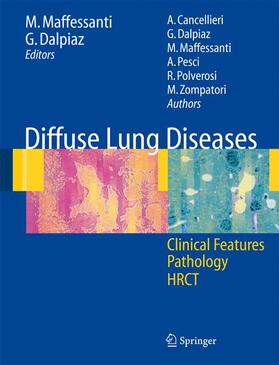 Diffuse Lung Diseases