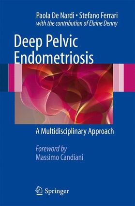 Deep Pelvic Endometriosis