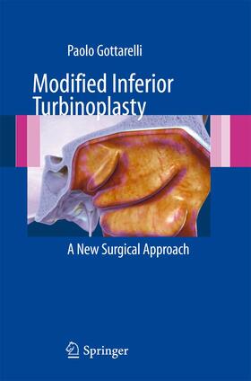 Modified Inferior Turbinoplasty