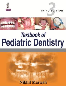 Textbook of Pediatric Dentistry