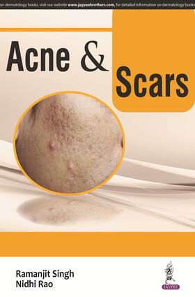ACNE and SCARS