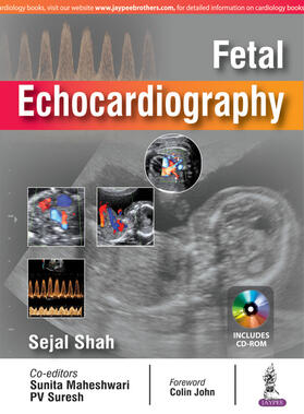 Fetal Echocardiography