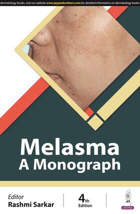 Melasma