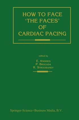 How to face ¿the faces¿ of CARDIAC PACING