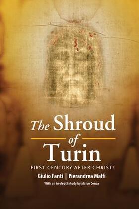 The Shroud of Turin