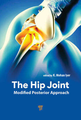 The Hip Joint