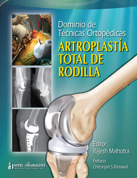 Dominio de Tecnicas Ortopedicas: Artroplastia Total de Rodilla