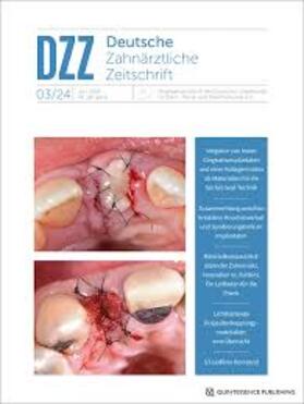 Deutsche Zahnärztliche Zeitschrift (DZZ)