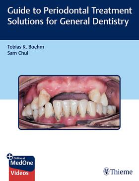 Boehm, T: Guide to Periodontal Treatment Solutions