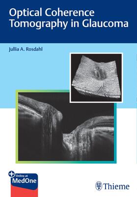 Rosdahl, J: Optical Coherence Tomography in Glaucoma