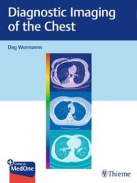 Wormanns, D: Diagnostic Imaging of the Chest