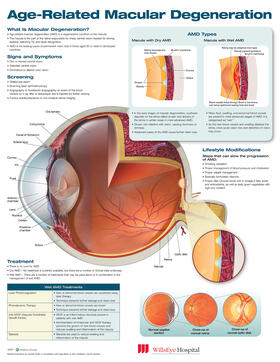 Age-Related Macular Degeneration