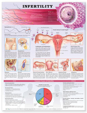 Infertility Anatomical Chart