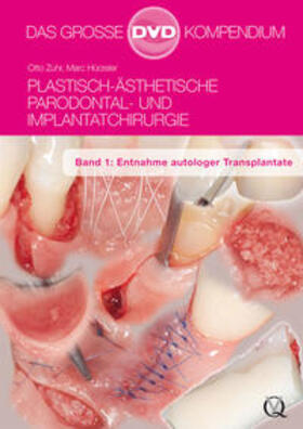 Plastisch-Ästhetische Parodontal- und Implantatchirurgie