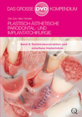 Plastisch-Ästhetische Parodontal- und Implantatchirurgie